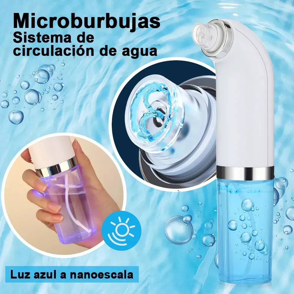 OEX Aqua - Extractor de succion puntos negros con agua